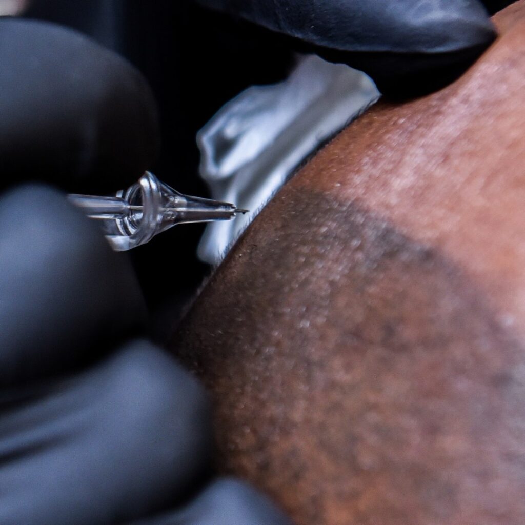 SMP, scalp micropigmentation technique performed on African American Man