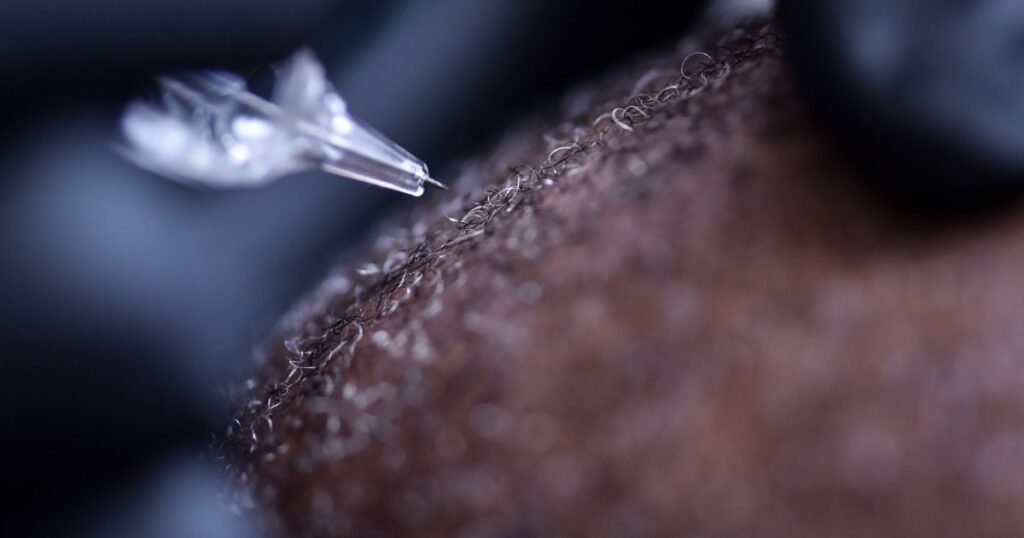 Close Up Of Scalp Micropigmentation treatment